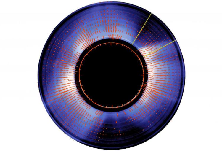 1980: The K Emission Line Polarimeter (KELP) was built in 1974 by the High Altitude Observatory (HAO) / NCAR in collaboration with the Sacramento Peak Observatory. KELP was designed to measure polarized light from the Sun’s atmosphere. Light is said to be polarized when many different waves of light vibrate along the same direction, instead of in all different directions. In the Sun’s corona, the magnetic field provides the preferred direction to polarize light. By measuring the polarization you can learn about the magnetic field, which is important because the field organizes the structure of the corona and the field can release energy that creates solar activity. KELP made successful observations of the direction of the coronal magnetic field that helped to prove the power of the technique of using polarization. KELP observations became even more informative in 1980 when they were combined with new daily images of the solar corona from the Mauna Loa Mk3 K-coronameter (in this figure, red lines denoting coronal magnetic field direction and polarization measured from KELP are overlayed on a Mk3 coronagraph image). Scientists could relate the direction of the magnetic field provided by KELP, to the structures of the corona shown in Mk3 images. These data gave scientists a better understanding of the shape of the coronal magnetic field and helped to determine the sources of the solar wind, the continuous stream of particles that escape the Sun and travel throughout the solar system.